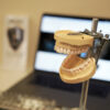 Dental model used for hands-on training in the Pinhole Surgical Technique® online course.